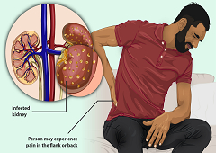 Dijagnoza bolesti bubrega