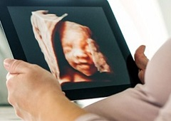 2D, 3D i 4D ultrazvuk u ginekologiji i trudnoći