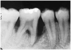 Osnovno o parodontologiji