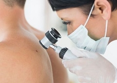 Preventivnim pregledom madeža smanjujemo rizik za nastanak malignog melanoma