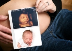 4D ultrazvuk u trudnoći
