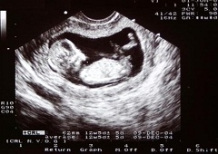 Zašto je važan ultrazvučni pregled u 12. tjednu trudnoće?
