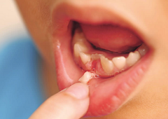 Gubitak mlječnih zubi djeca doživljavaju kao pozitivno iskustvo
