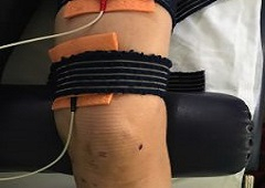 Fizikalna terapija i poslijeoperacijska rehabilitacija koljena