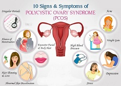 Sindrom policističnih jajnika - PCOS (Polycystic Ovarian Syndrome)