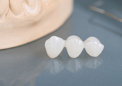 Koje su mogućnosti kod nedostatka, gubitka ili uništenja zubi?